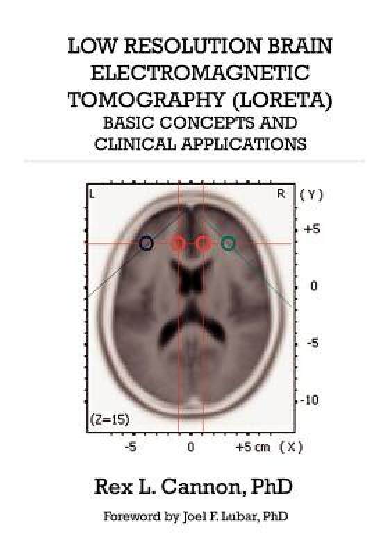 【预售】Low Resolution Brain Electromagnetic Tomography