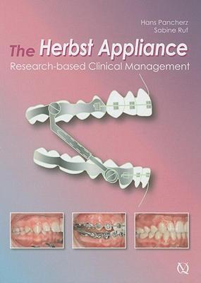 【预售】The Herbst Appliance: Research-Based Clinical
