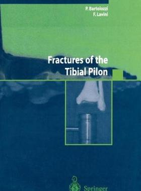 【预售】Fractures of the Tibial Pilon
