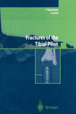 【预售】Fractures of the Tibial Pilon