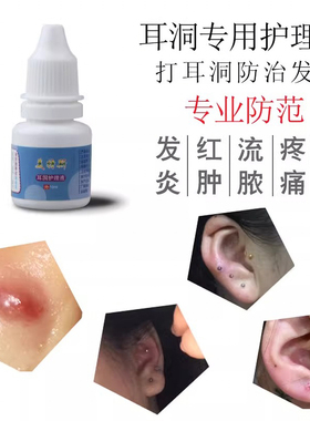 耳洞消炎护理消毒水红肿发炎液