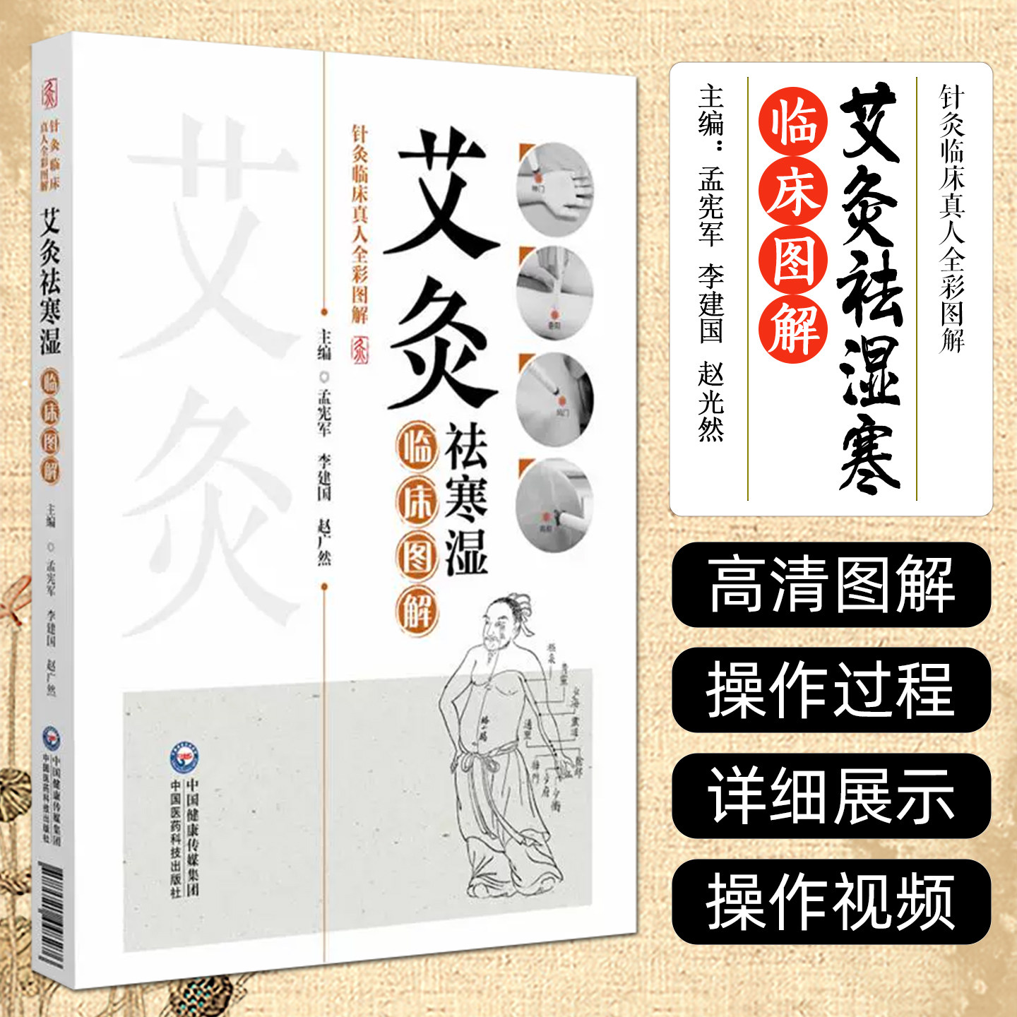 艾灸祛寒湿临床图解(针灸临床真人全彩图解) 中国医药科技出版社9787521448276