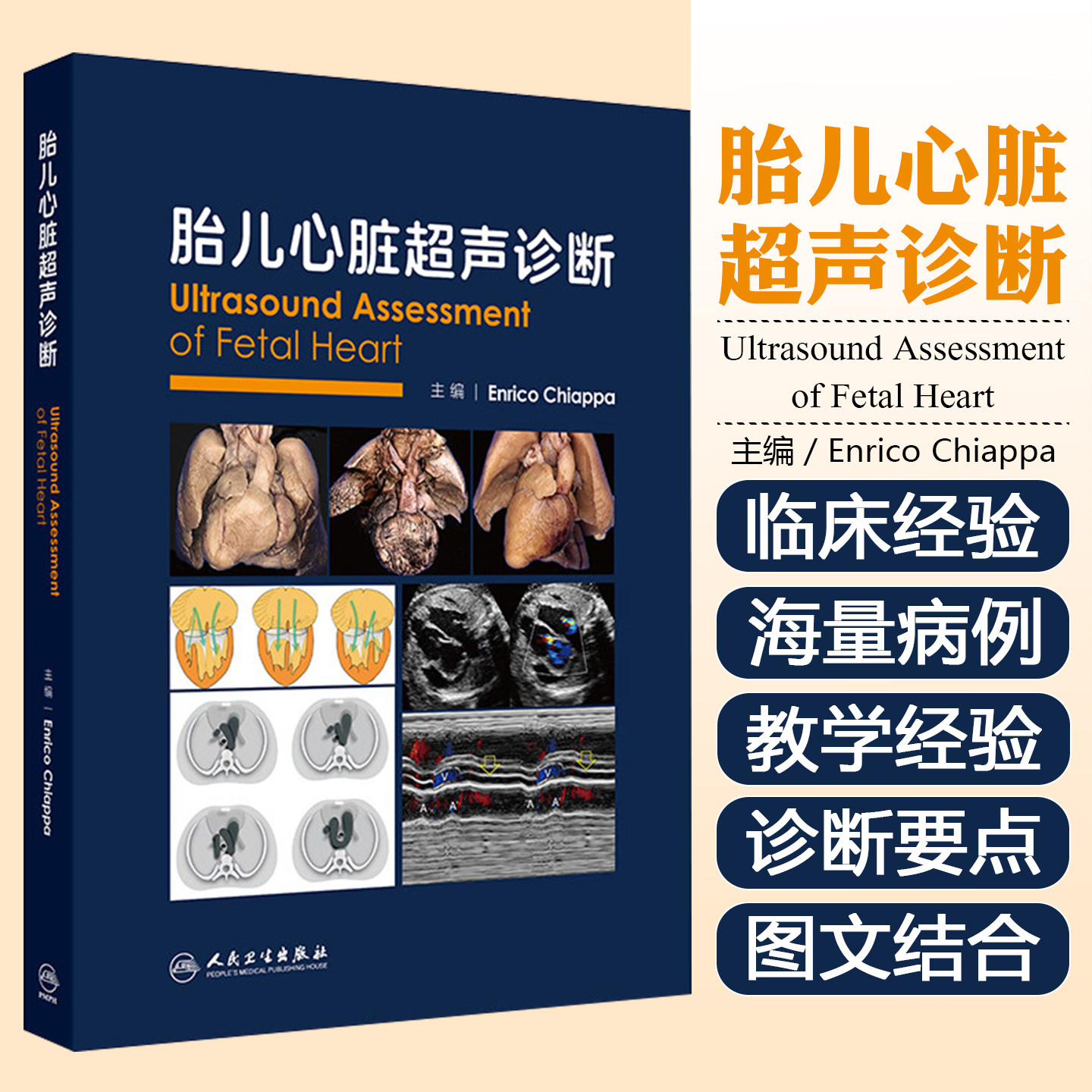 胎儿心脏超声诊断人民卫生出版社9787117393188
