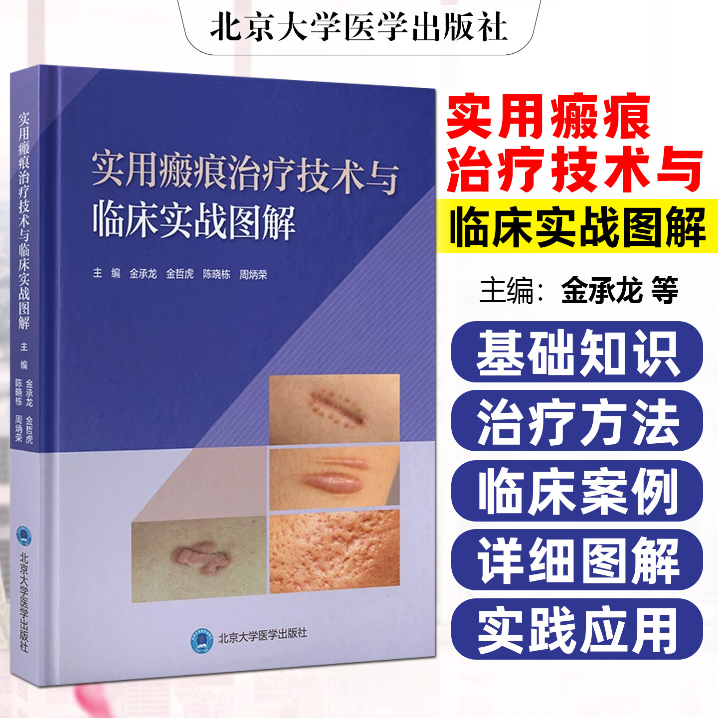 实用瘢痕治疗技术与临床实战图解 金承龙金哲虎陈晓栋周炳荣北 皮肤病瘢痕基础知识治疗方法京大学医学出版社9787565936777