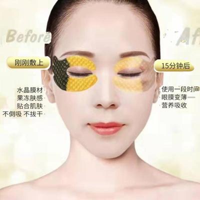 黑眼圈眼袋细纹2年眼膜贴