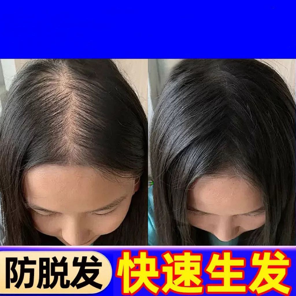 咖加角洗发水防脱发生发控油蓬松去屑止痒山姆加角正品官方店