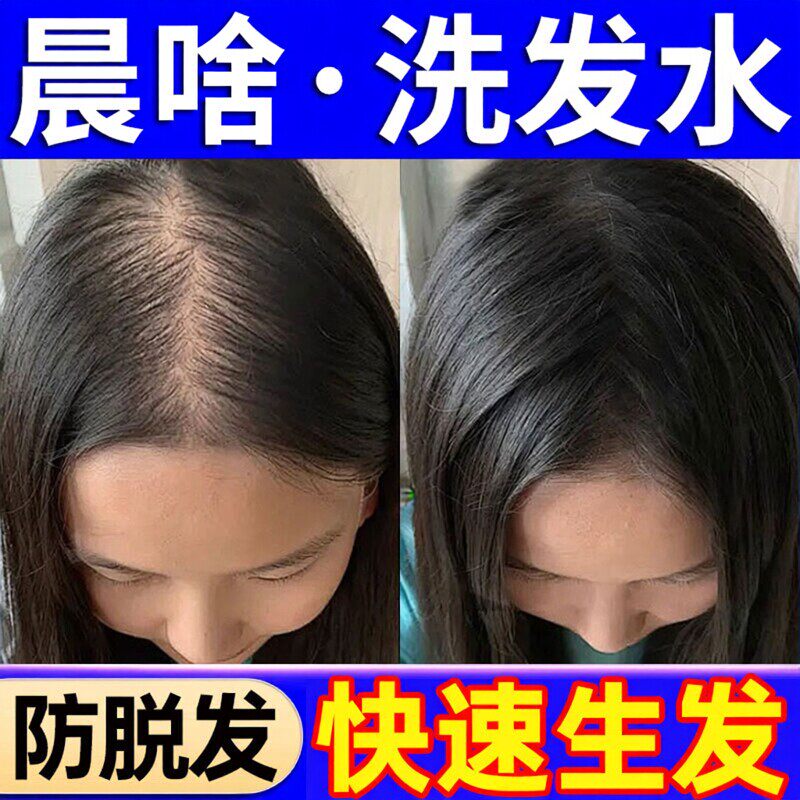 晨含洗发水官方店防脱发生发控油蓬松去屑止痒胖东来正品