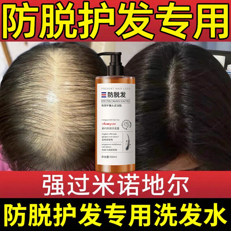 集羽萱洗发水防脱发蓬松控油生发变黑发去屑止痒增密官方店