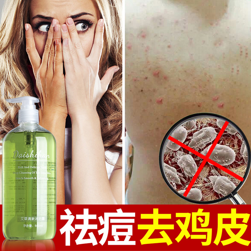 艾草沐浴露变白螨虫去鸡皮肤疙瘩止痒去后背痘痘屁股痘男女士孕妇