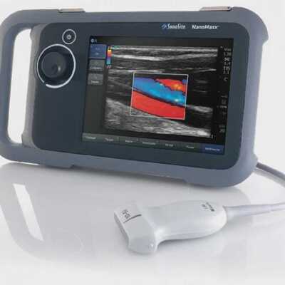 SONOSITE NANOMAXX PORTABLE ULTRASOUND CARDIO IMAGING DOPPLER