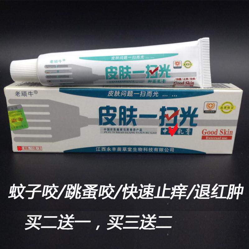 被跳蚤咬了擦什么药用蚂蚁螨虫被虫子咬的药膏蚊叮虫咬止痒喷雾涂
