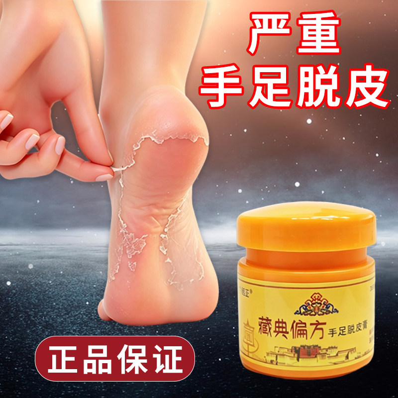 手足脱皮膏官方正品手足干裂脱皮膏手脚起皮蜕皮粗糙保湿膏
