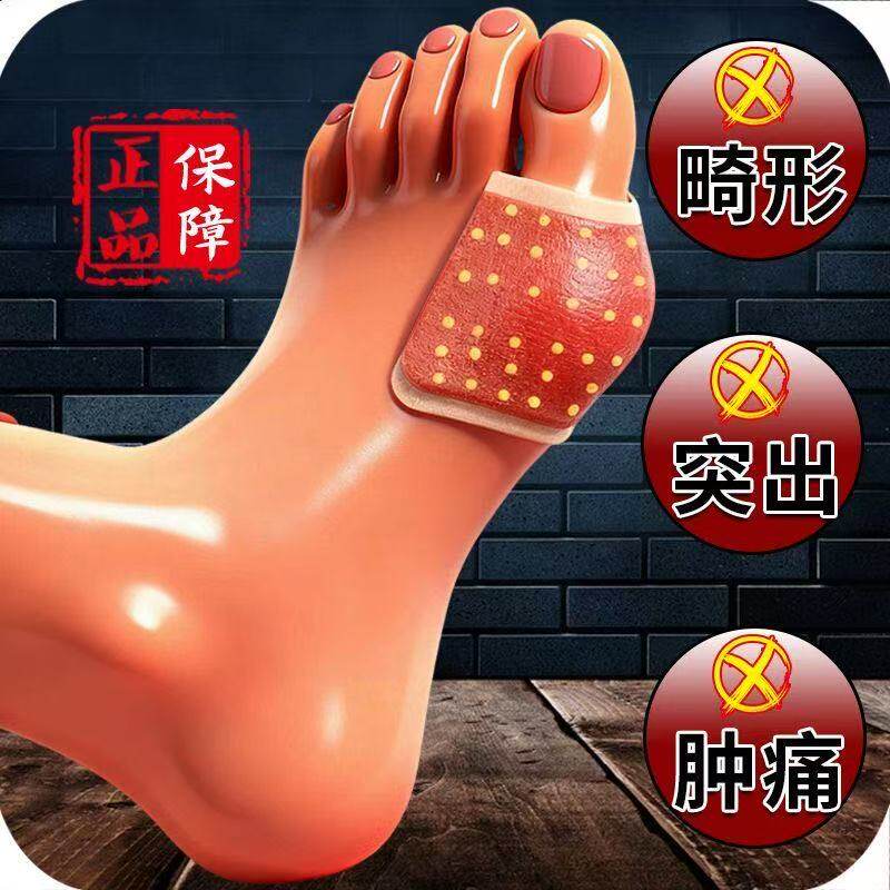 【正品】严重大脚骨外翻贴凸出脚趾重叠关节畸形肿胀疼痛专用贴