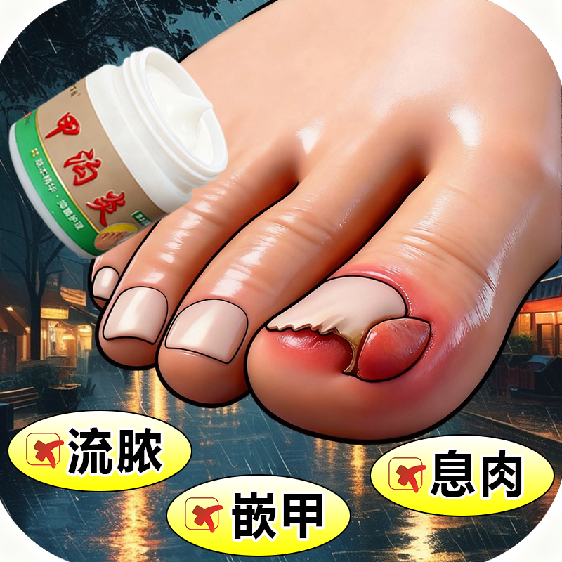 甲沟脚指甲疼大拇指往肉里长销肿感染发红肿化脓脚指甲止痛膏