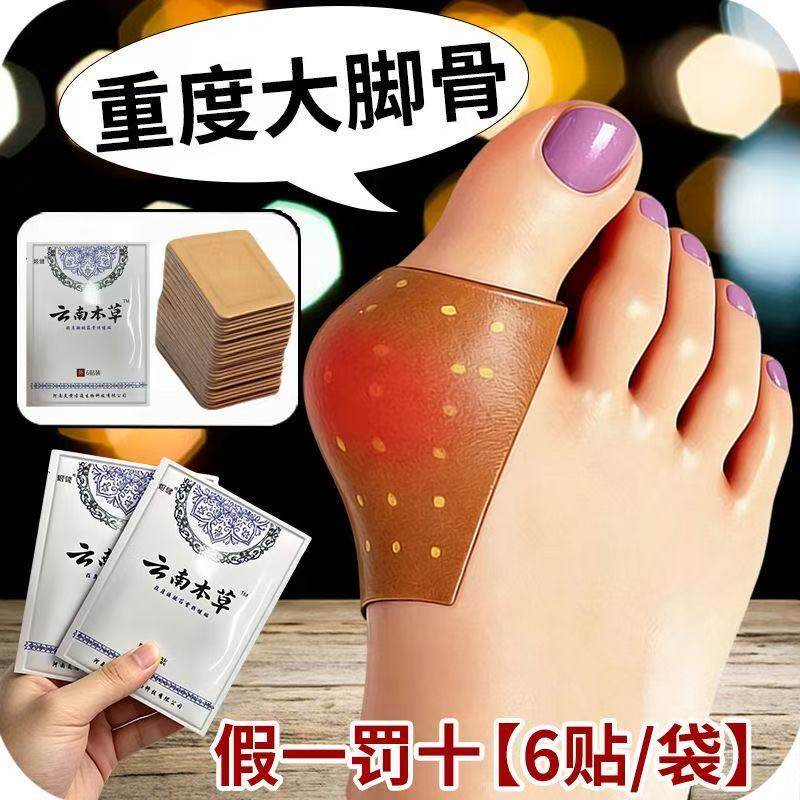 【正品保障】拇外翻疼痛拇指外翻大脚骨变形脚趾重叠女士专用膏贴
