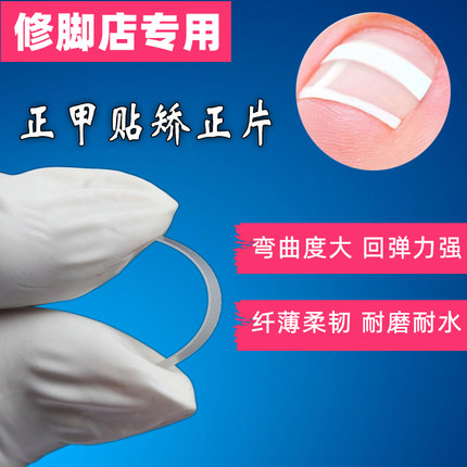 正甲贴指趾甲沟矫正器炎脚嵌甲矫正弹片隐形德国bs进口贴片拉拉贴