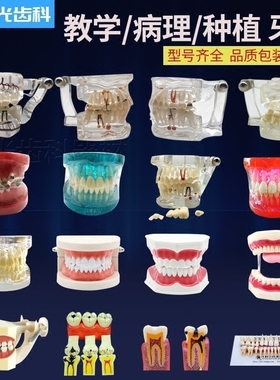 牙模型牙科教学模型可拆卸医患沟通教学备牙牙齿口腔假牙模型摆件