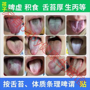 一对一儿童健脾消积食贴内热舌苔厚黄地图舌小儿调理健脾胃肠胃贴
