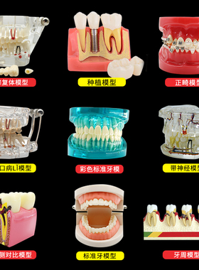 牙科教学牙模型模具全口正畸牙齿模型标准模型可拆卸齿科口腔成人