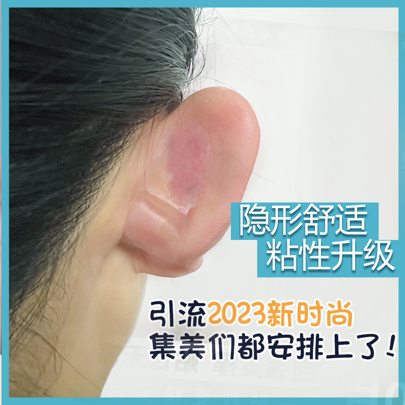 精灵耳贴强支撑耳朵固定贴变招风耳隐形舒适矫正硅胶立显脸小神器