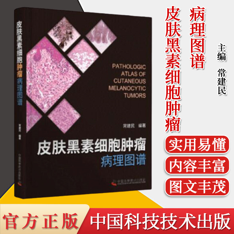 正版现货 皮肤黑素细胞肿瘤病理图谱 常建民 中国科学技术出版社9787504687586