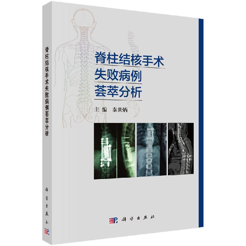 脊柱结核手术失败病例荟萃分析 医学参考书籍 外科学参考书籍 临床医学 2019年11月DIYI版 秦世炳编著 9787030629661 科学出版社