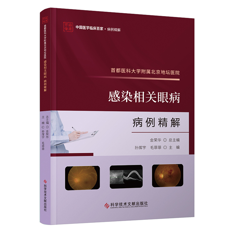 首都医科大学附属北京地坛医院感染相关眼病病例精解 孙挥宇 毛菲菲 科学技术文献出版社9787523511961