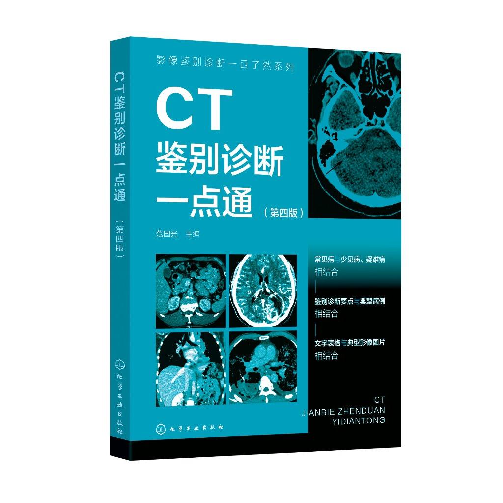 影像鉴别诊断一目了然系列--CT鉴别诊断一点通(第四版)范国光 主编 化学工业出版社9787122462541