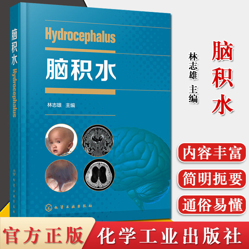 脑积水 林志雄 主编 显微外科神经内镜神经外科学脑血管脑外科颅脑损伤书籍手术 化学工业出版社 9787122370945