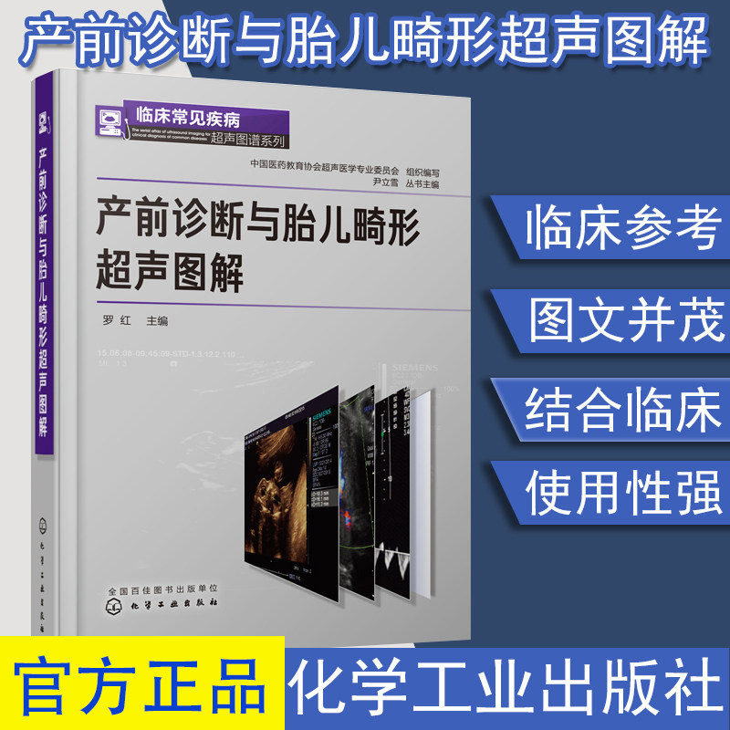 产前诊断与胎儿畸形超声图解 胎儿畸形产前超声诊断学书籍 临床妇科常见疾病诊断治疗医学书籍 妇科书 临床常见疾病超声图谱系列