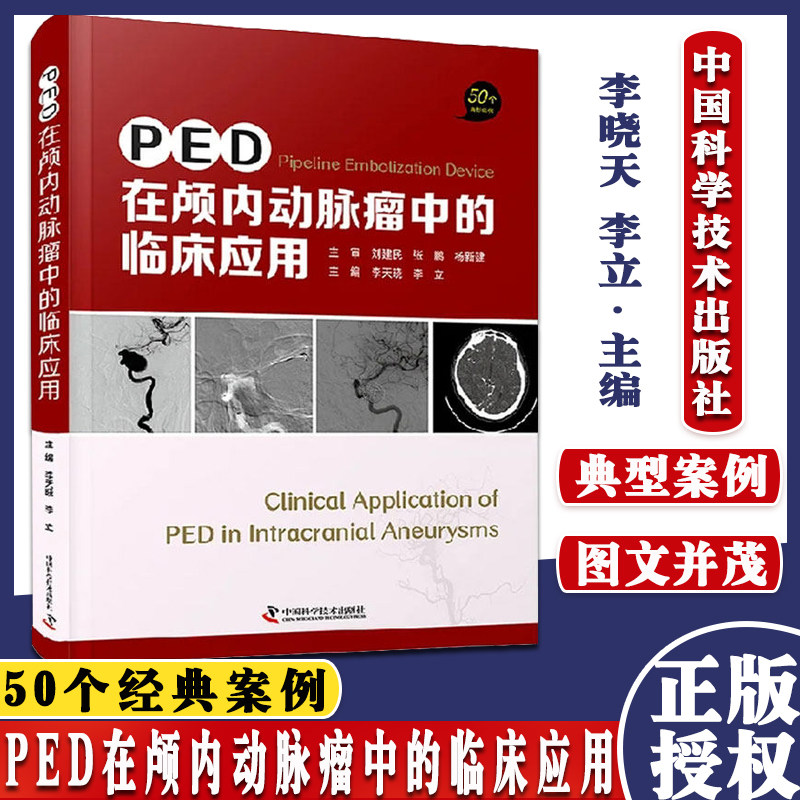 PED在颅内动脉瘤中的临床应用 50个经典案例 李晓天 李立 中国科学技术出版社 9787504690364