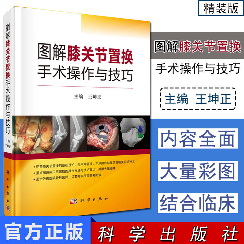 图解膝关节置换手术操作与技巧 微创技术 导航技术 3D打印技术及机器人在人工膝关节置换中的应用 王坤正主编 9787030616418