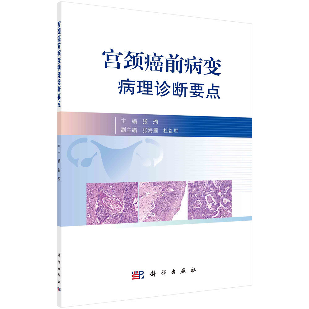 ys宫颈癌病变诊断要点科学