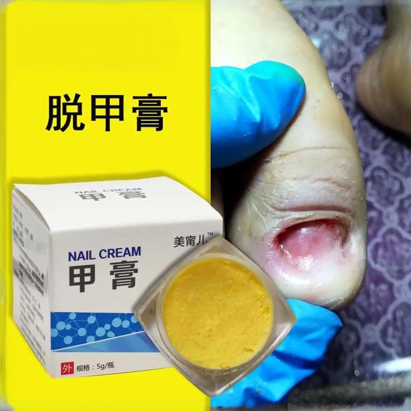指甲专用脱坏甲膏软甲膏快速脱甲无痛净去除变色增厚除菌特效膏