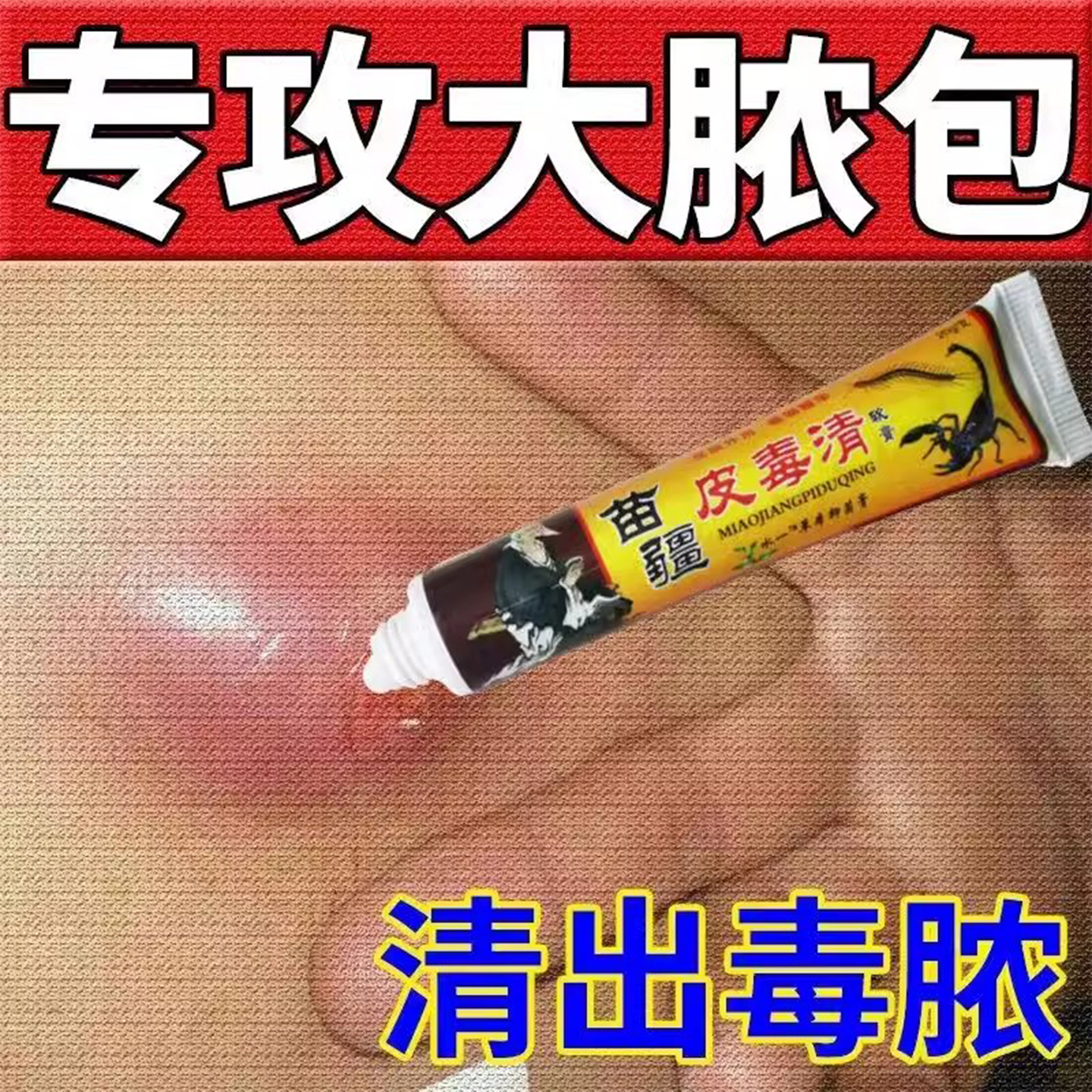苗疆火疖子拔脓膏硬疙瘩消除药膏