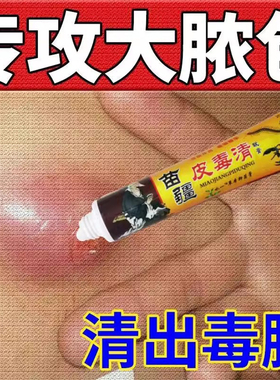 苗疆火疖子拔脓膏拔掉毒膏脓包屁股肛周红痛肿吸脓脸部痘痘神器