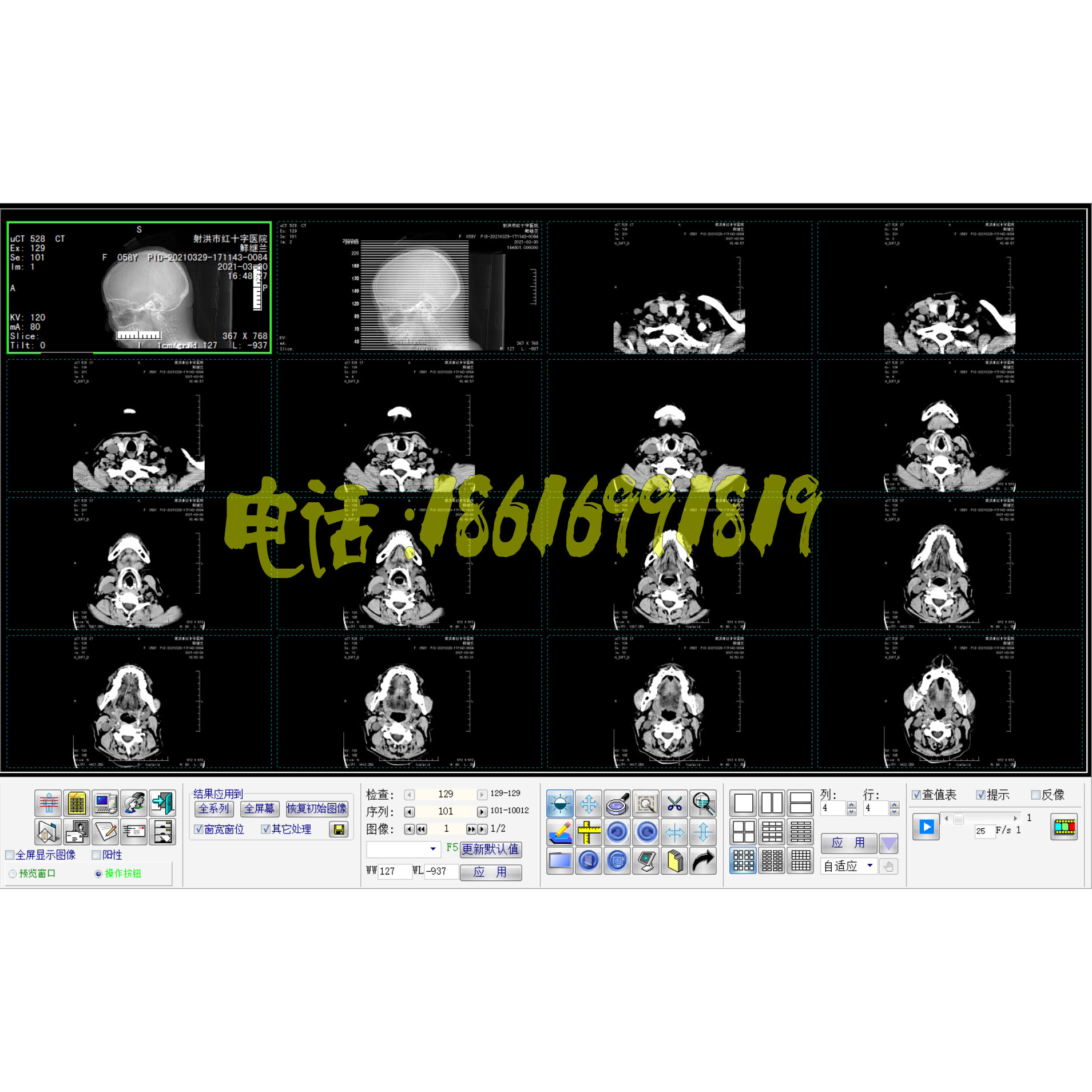 CT影像工作站DR工作站CR软件MR软件DSA软件PACS系统胃肠C臂工作站