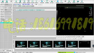 超声高清软件彩超软件超声影像软件超声软件注册机加密狗