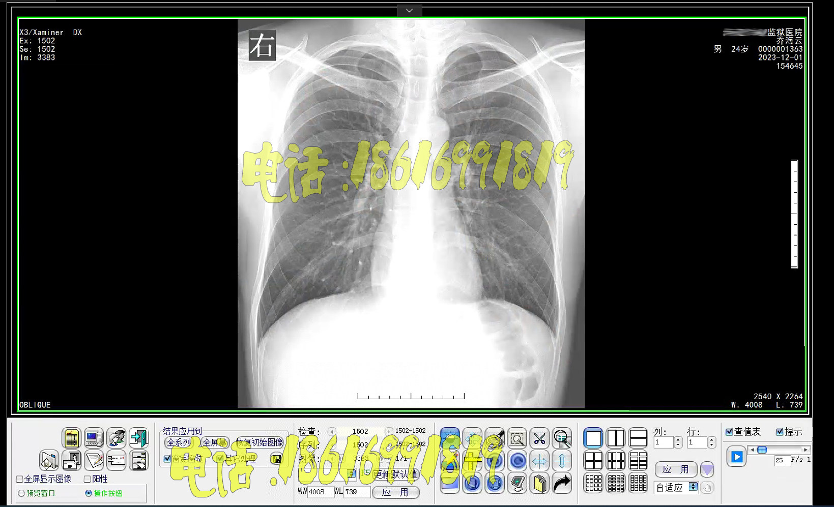CT工作站软件CT软件DR工作站软件CR工作站软件DSA软件核磁软件