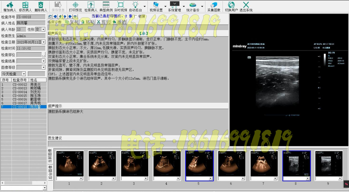 超声软件B超软件彩超软件+视频采集卡+脚踏板+连接线脚踏全套包邮