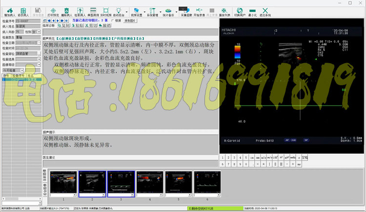 超声软件B超软件注册机四维彩超彩超工作站软件Win7Win10加