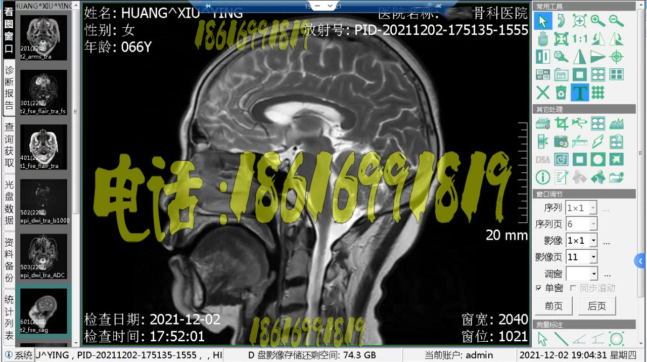 DR软件DR工作站CR软件CT工作站软件MRI软件DSA软件放射科pacs软件