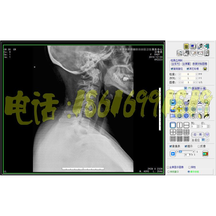 DR工作站软件DR软件CR软件MR软件PACS系统胃肠C臂工作站DSA软件