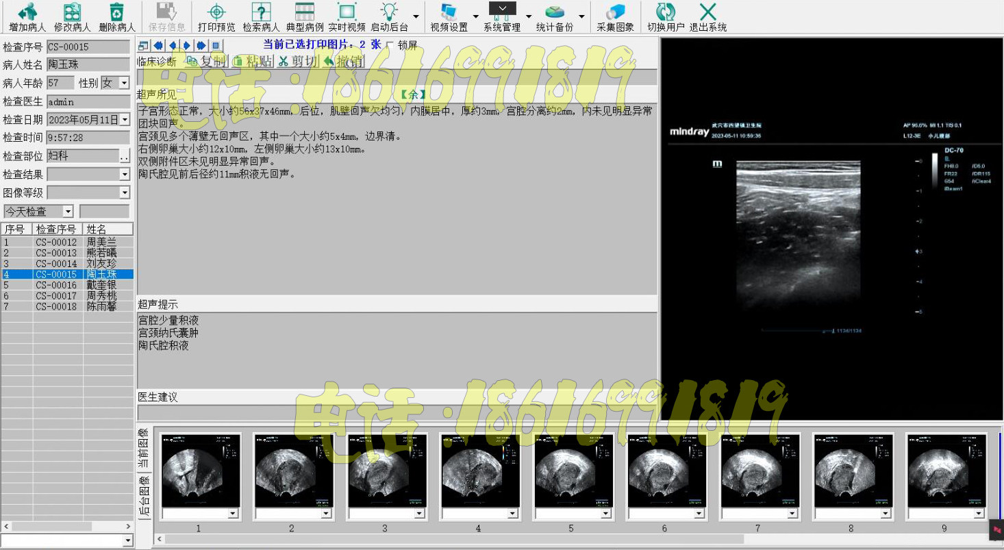 彩超软件B超软件超声工作站软件+采集卡+脚踏板+连接线全套包邮