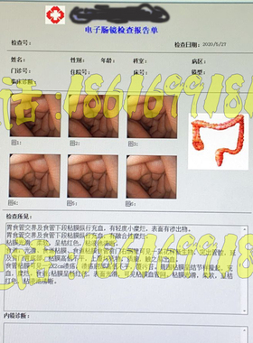 胃肠镜软件耳鼻喉镜宫腔镜腹腔镜支气管镜内窥镜软件XPwin7/win10