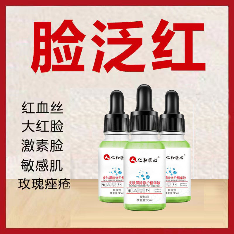 玫瑰痤疮修复药膏非伊维菌素治疗脸上的草本祛痘酒糟鼻发红退泛红