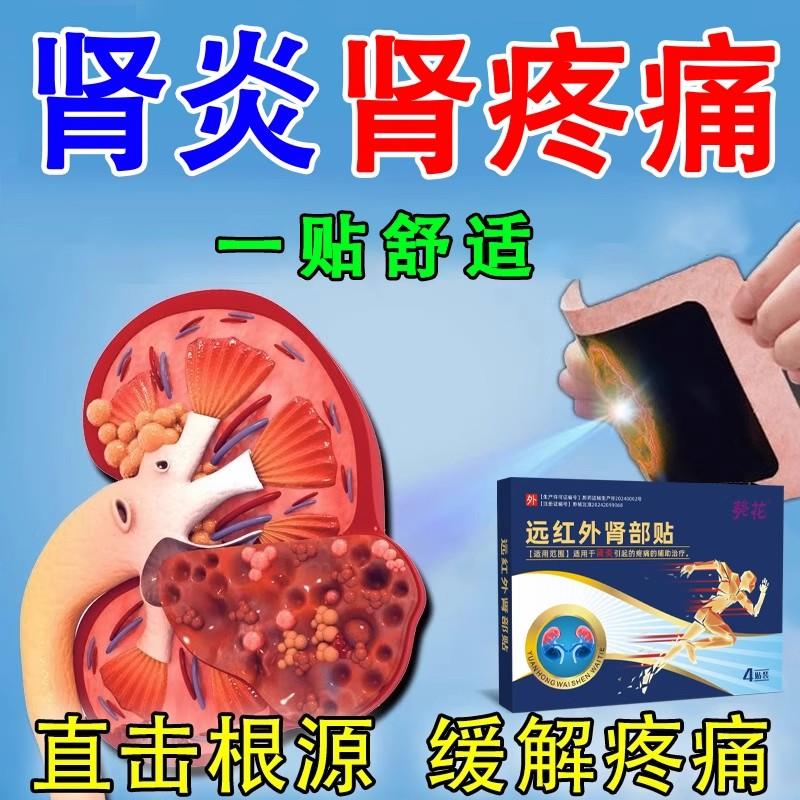 远红外治理疗贴正品肾炎疼痛囊肿结石肾功能下降多尿官方正品aw