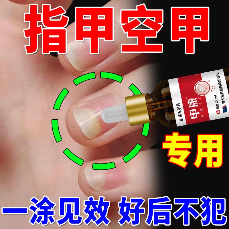 空指甲修覆手指甲肉分离空真菌感染空甲修覆液专用药WT