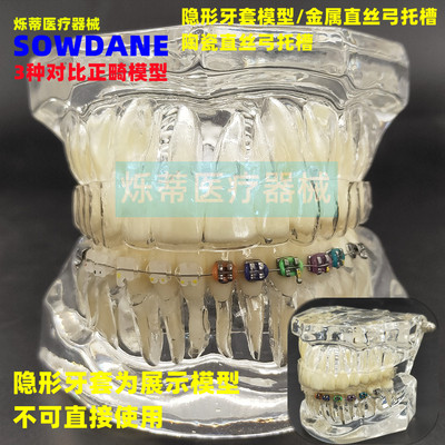 海烁正畸模型包邮齿科