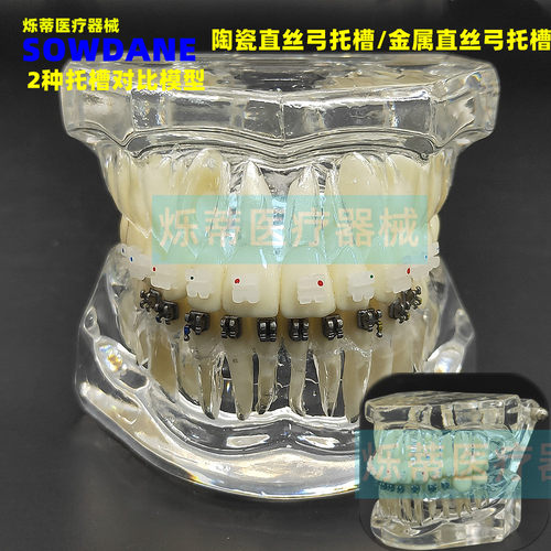 海烁正畸模型包邮透明牙模